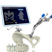 Computer-Navigated Total Hip Replacement